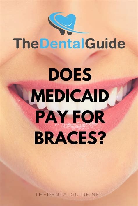 Does Medicaid Pay For Braces The Dental Guide