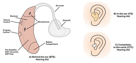 2 Diagram Of Dierent Hearing Aid Styles A Behind The Ear Bte Download Scientific Diagram