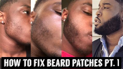 How To Fix Beard Patches Pt 1 Youtube