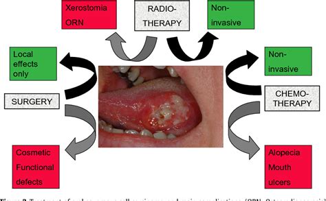 Oral Squamous Cell Carcinoma Overview Semantic Scholar