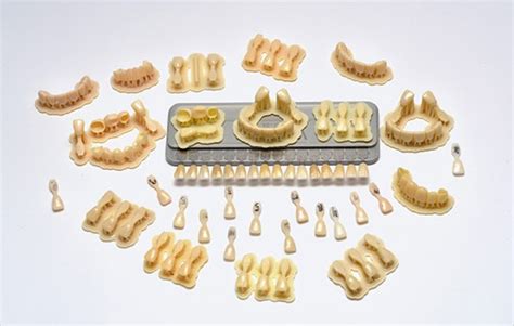 Temporary Crown Bridge Dental Material For 3D Printing Implants