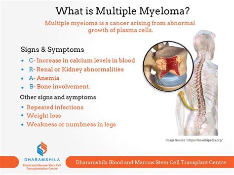 Pin By Aalijah Muhammad On Quick Saves Multiple Myeloma Myeloma