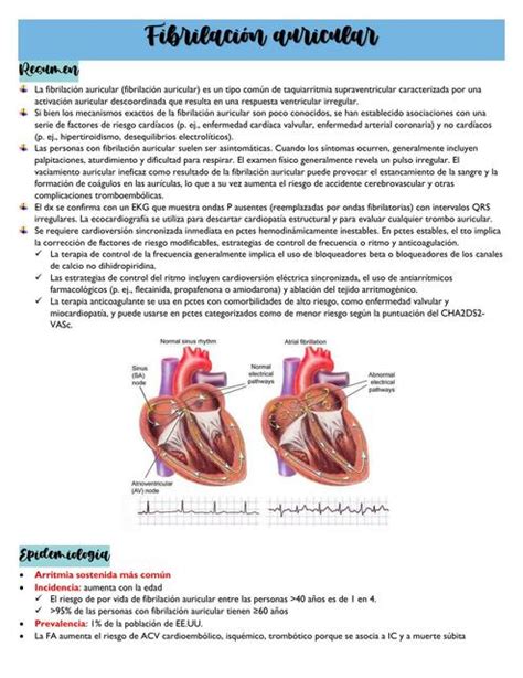 Fibrilación Auricular Completo Jess uDocz