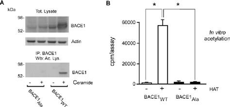 Figure From A Reversible Form Of Lysine Acetylation In The Er And