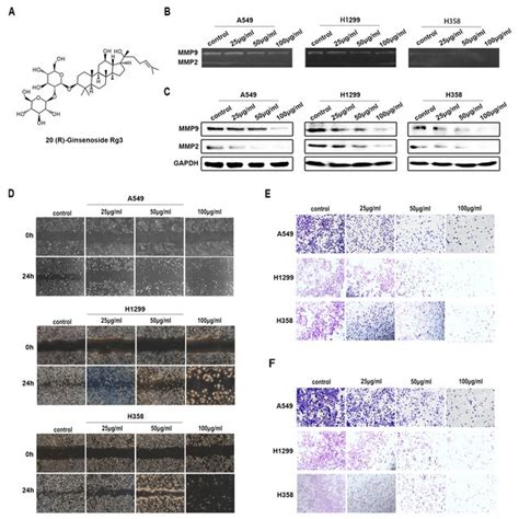 Rg Inhibited Migration And Invasion Of Human Nsclc Cells A Structure