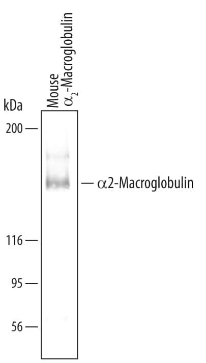 alpha 2-Macroglobulin Antibody (AF5798): Novus Biologicals