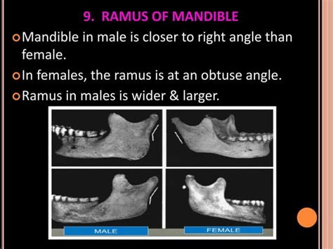 Sex Determination In Forensic PPTX