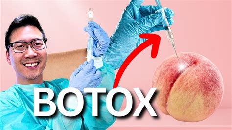 Do I Need Botox Anal Fissure And Spasm Treatment Youtube