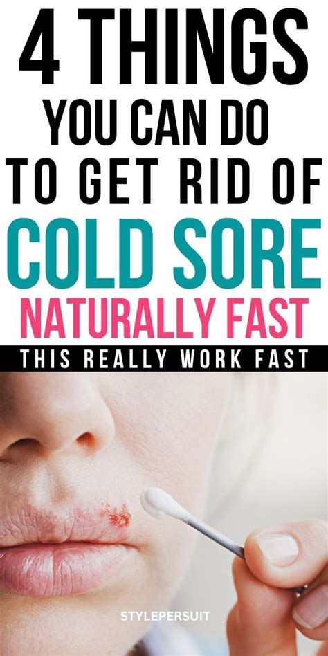 How To Get Rid Of Cold Best Cold Sore Remedy That Work Fast En 2024