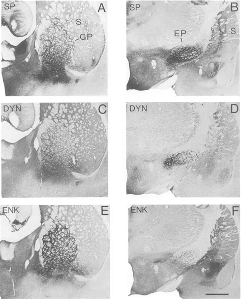 Low Power Photomicrographs Showing PAP Labeled Sections Through Two