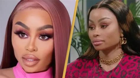 Blac Chyna Reveals Why She S Having Reverse Cosmetic Procedures