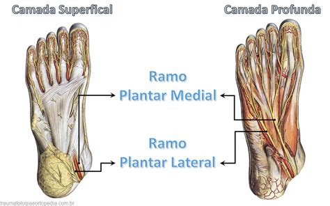 Compressão Dos Nervos Plantar Medial E Plantar Lateral Traumatologia