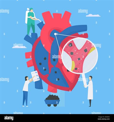 Cardiology Vector Illustration This Disease Calls Endocarditis It Is