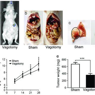 Establishment Of Vagotomy In An Orthotopic Xenograft Nude Mouse Model