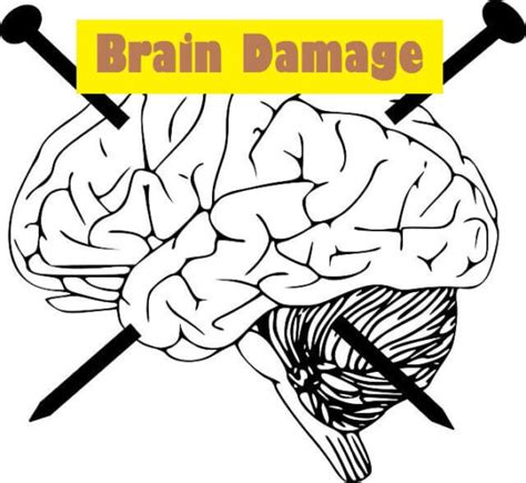 15 Brain Damage Causes And Symptoms » 2024