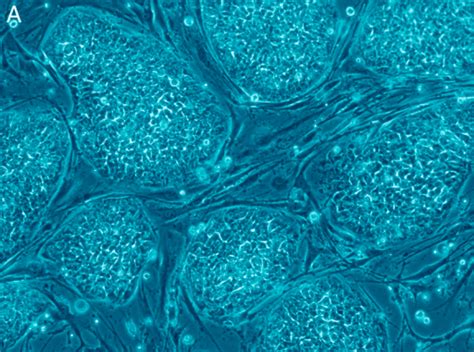 Curing Diseases With Embryonic Stem Cells Proving Much Harder Than Expected Genetic Literacy