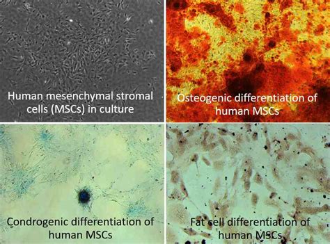 Mesenchymal Stromal Cell Culture And Differentiation Neural