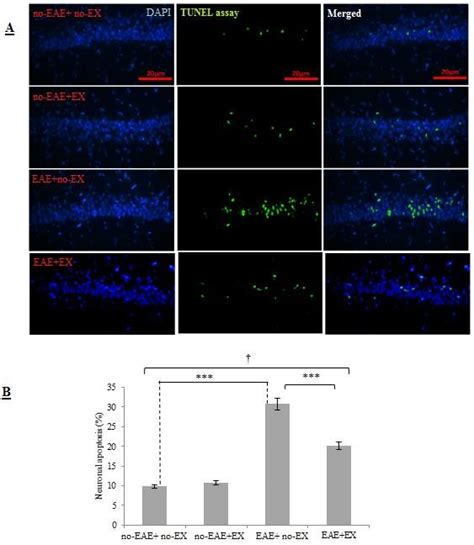 Percentage Of Hippocampal Neuronal Apoptosis Tunel Cells In Four