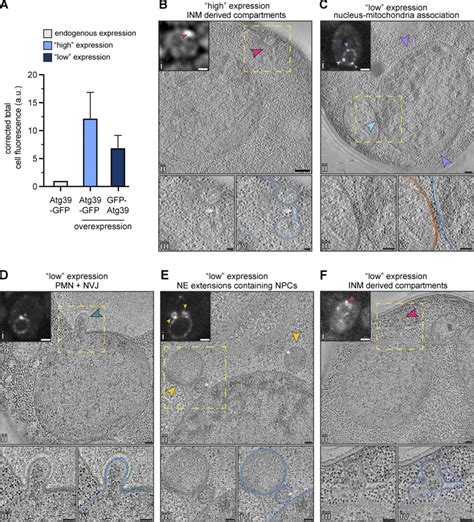 NE Ultrastructure At Sites Of Atg39 Accumulation Supplemental To Fig