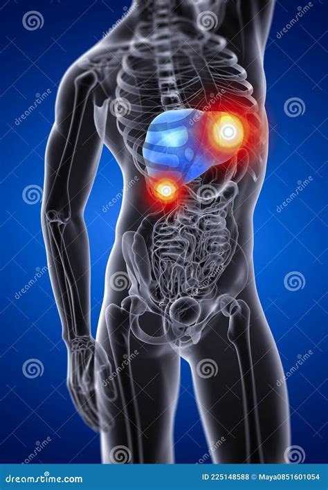 3d Render Medical Illustration Of The Liver Stock Illustration Illustration Of Spleen Human