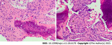 Pathological Examination Result The Lesion Based On Preoperative