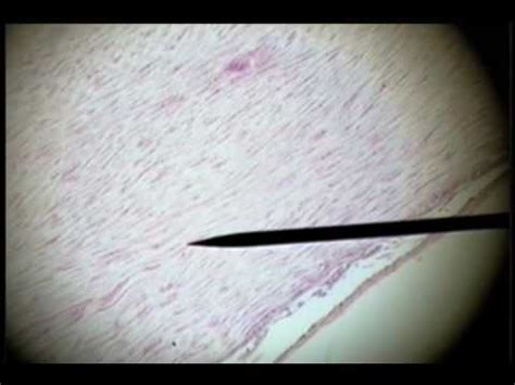 Ligamentum Nuchae Histology