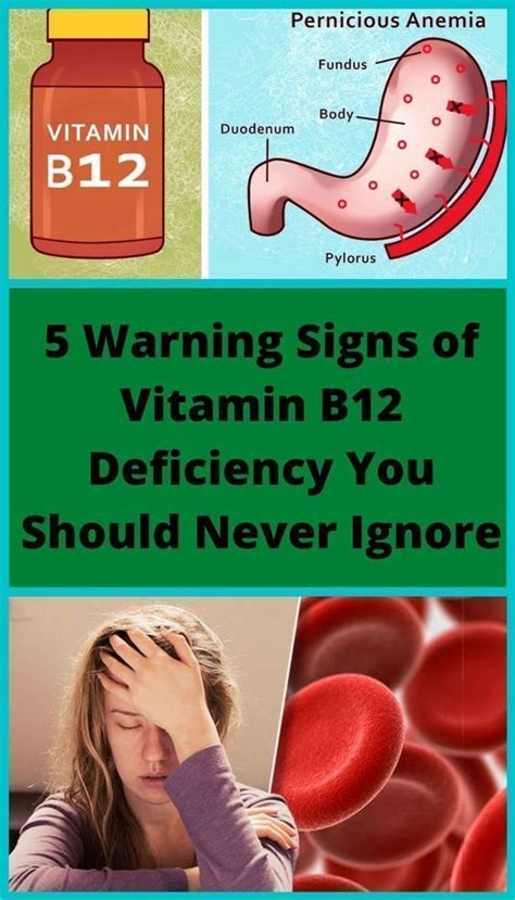 5 Warning Signs Of Vitamin B12 Deficiency You Should Never Ignore B12