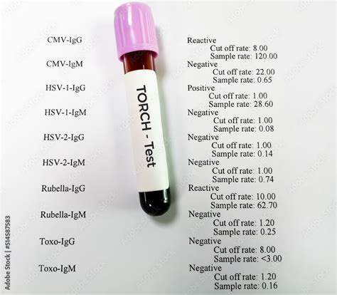 Blood Sample For Torch Test Torch Panel Testtoxoplasma Rubella