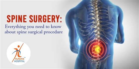 Spine Surgery Everything You Need To Know About Spine Surgical Procedure