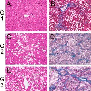 Representative Histopathologic Findings In The Central Nervous System