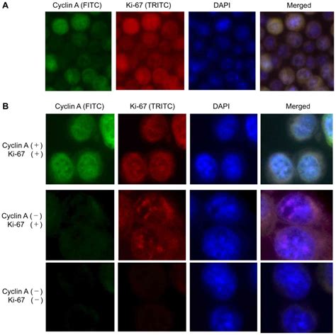 Cyclin A Is A Reliable Proliferation Marker In Endometrial Cancer Cell