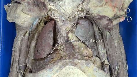 From Grants Dissection Video Collection Anterior Thoracic Wall And