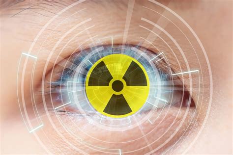 Radiation Cataractogenesis Understanding Clinical Consequences