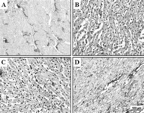 Myocardial Staining For Total Collagen Collagen Subtypes I Alpha And