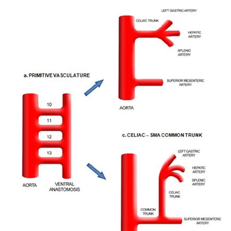 Embryology of normal vascular anatomy and variant celiac-SMA trunk. In ...