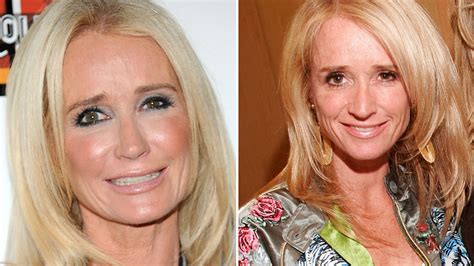 Kim Richards' New Nose -- See "Real Housewives" Pre-Plastic Surgery!