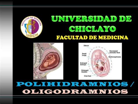 Polihidramnios Oligohidramnios Ppt