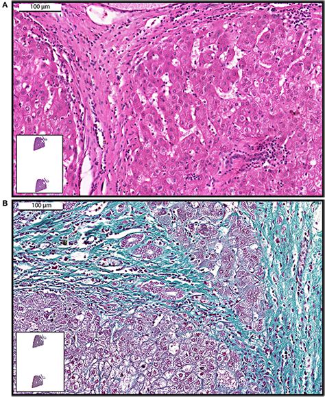 Frontiers Whole Slide Imaging And Its Applications To