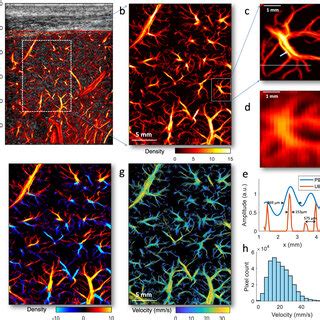 A Full Fov Super Resolution Ulm Microvessel Image Of The Healthy