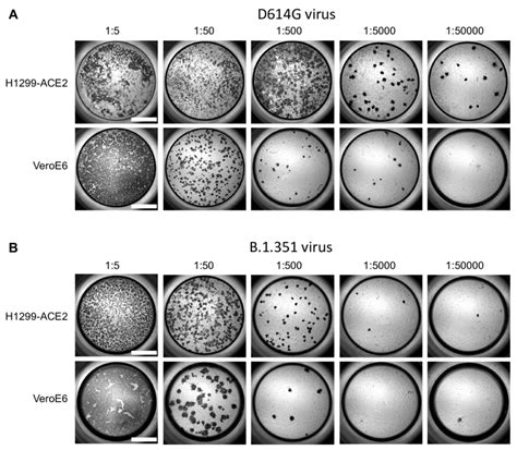 Figure S4 Comparision Of Sars Cov 2 Infection In H1299 Ace2 And Veroe6 Download Scientific