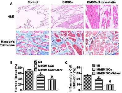 Reduction Of Cardiac Fibrosis And Inflammatory Cell Infiltration By