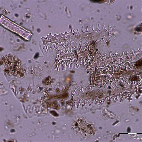 Phytoliths from sample B26. | Download Scientific Diagram