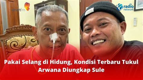 Pakai Selang Di Hidung Kondisi Terbaru Tukul Arwana Diungkap Sule