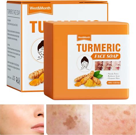 Turmeric Soap Kojic Acid Soap Skin Lightening Kojic Acid Dark Spot Remover Soap Bars Kojic