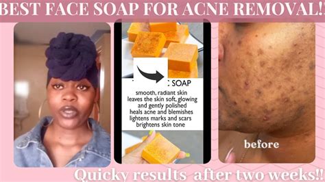 How To Use Turmeric Facial Soap For Faster Results Best Facial Soap