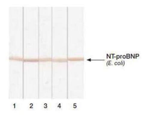 NT-proBNP Antibody (24E11cc) 0.5mg; Unlabeled:Antibodies, Monoclonal ...