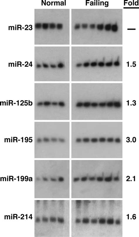 Mirna Expression In Human Heart Failure Northern Blot Analysis Of