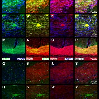 Transplanted Stem Cell Fate Favors Oligodendrocytic Lineage And Cells