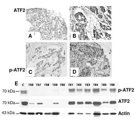 Figure 1 Expression And Prognostic Value Of Activating Transcription