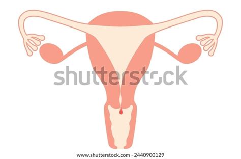 Diagrammatic Illustration Cervical Polyps Anatomy Uterus Stock Vector